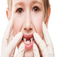 4 خطوات لحماية اسنان طفلك من التسوس